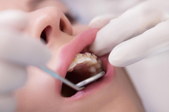 rehabilitacion oral malaga